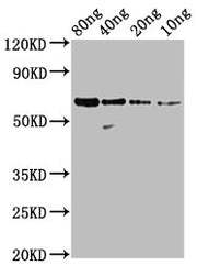 Western Blot Positive WB detected in Recombinant protein All lanes: N antibody at 1:2000 Secondary Goat polyclonal to rabbit IgG at 1/50000 dilution Predicted band size: 59 kDa Observed band size: 59 kDa