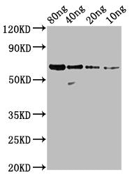 Western Blot Positive WB detected in Recombinant protein All lanes: N antibody at 1:2000 Secondary Goat polyclonal to rabbit IgG at 1/50000 dilution Predicted band size: 59 kDa Observed band size: 59 kDa