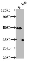 Western Blot Positive WB detected in Recombinant protein All lanes: SWD2 antibody at 1:2000 Secondary Goat polyclonal to rabbit IgG at 1/50000 dilution Predicted band size: 40.2 kDa Observed band size: 46 kDa