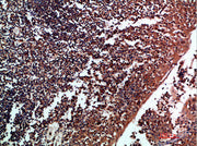 Immunohistochemical analysis of paraffin-embedded human-tonsil, antibody was diluted at 1:200