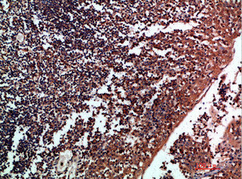 Immunohistochemical analysis of paraffin-embedded human-tonsil, antibody was diluted at 1:200