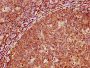 IHC image of CSB-PA340307LA01HU diluted at 1:500 and staining in paraffin-embedded human tonsil tissue performed on a Leica BondTM system. After dewaxing and hydration, antigen retrieval was mediated by high pressure in a citrate buffer (pH 6.0)....