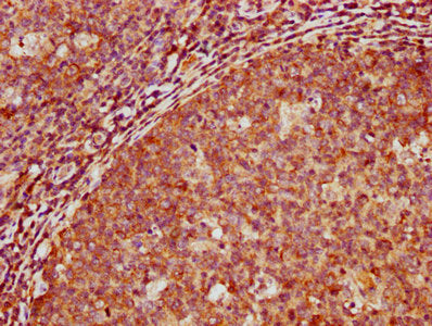 IHC image of CSB-PA340307LA01HU diluted at 1:500 and staining in paraffin-embedded human tonsil tissue performed on a Leica BondTM system. After dewaxing and hydration, antigen retrieval was mediated by high pressure in a citrate buffer (pH 6.0)....