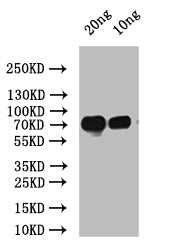 Western Blot Positive WB detected in: recombinant protein All lanes: spaP Antibody at 1:1000 Secondary Goat polyclonal to rabbit IgG at 1/50000 dilution Predicted band size: 60 kDa Observed band size: 60 kDa