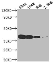 Western Blot Positive WB detected in Recombinant protein All lanes: VCATH antibody at 1:2000 Secondary Goat polyclonal to rabbit IgG at 1/50000 dilution Predicted band size: 39.9 kDa Observed band size: 40 kDa