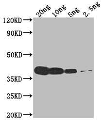 Western Blot Positive WB detected in Recombinant protein All lanes: VCATH antibody at 1:2000 Secondary Goat polyclonal to rabbit IgG at 1/50000 dilution Predicted band size: 39.9 kDa Observed band size: 40 kDa