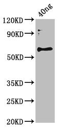 Western Blot Positive WB detected in Recombinant protein All lanes: botF antibody at 3.5ug/ml Secondary Goat polyclonal to rabbit IgG at 1/50000 dilution Predicted band size: 60 kDa Observed band size: 60 kDa