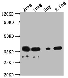 Western Blot Positive WB detected in Recombinant protein All lanes: DERP2 antibody at 1:2000 Secondary Goat polyclonal to rabbit IgG at 1/50000 dilution Predicted band size: 30.1 kDa Observed band size: 38 kDa