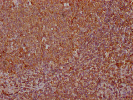IHC image of CSB-PA343703LA01HU diluted at 1:100 and staining in paraffin-embedded human tonsil tissue performed on a Leica BondTM system. After dewaxing and hydration, antigen retrieval was mediated by high pressure in a citrate buffer (pH 6.0)....