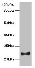 Western blot All lanes: IFNAG antibody at 2µg/ml + HL60 whole cell lysate Secondary Goat polyclonal to rabbit IgG at 1/10000 dilution Predicted band size: 22 kDa Observed band size: 22 kDa
