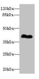 Western blot All lanes: ROM1antibody at 0.98ug/ml + Mouse ocular tissue Secondary Goat polyclonal to rabbit IgG at 1/10000 dilution Predicted band size: 37 kDa Observed band size: 37 kDa