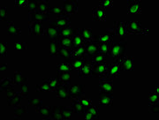 Immunofluorescence staining of Hela cells with CSB-PA345128LA01HU at 1:100, counter-stained with DAPI. The cells were fixed in 4% formaldehyde, permeabilized using 0.2% Triton X-100 and blocked in 10% normal Goat Serum. The cells were then incubat...