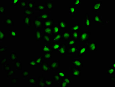 Immunofluorescence staining of Hela cells with CSB-PA345128LA01HU at 1:100, counter-stained with DAPI. The cells were fixed in 4% formaldehyde, permeabilized using 0.2% Triton X-100 and blocked in 10% normal Goat Serum. The cells were then incubat...