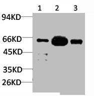 Western blot analysis of 1) Mouse BrainTissue, 2)Rat Brain Tissue, 3) Jurkat with KCNK10(TREK-2) Rabbit pAb diluted at 1:2,000.