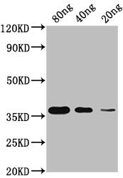 Western Blot Positive WB detected in Recombinant protein All lanes: Copper-metallothionein antibody at 1:2000 Secondary Goat polyclonal to rabbit IgG at 1/50000 dilution Predicted band size: 35 KDa Observed band size: 35 KDa