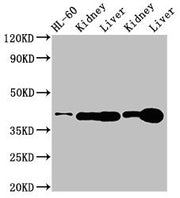 Western Blot Positive WB detected in: HL60 whole cell lysate, Rat kidney tissue, Rat liver tissue, Mouse kideny tissue, Mouse liver tissue All lanes: ADK antibody at 3ug/ml Secondary Goat polyclonal to rabbit IgG at 1/50000 dilution Predicted band...