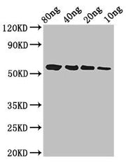 Western Blot Positive WB detected in Recombinant protein All lanes: btfP antibody at 3ug/ml Secondary Goat polyclonal to rabbit IgG at 1/50000 dilution Predicted band size: 58 kDa Observed band size: 58 kDa