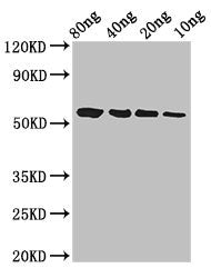 Western Blot Positive WB detected in Recombinant protein All lanes: btfP antibody at 3ug/ml Secondary Goat polyclonal to rabbit IgG at 1/50000 dilution Predicted band size: 58 kDa Observed band size: 58 kDa