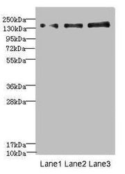 Western blot All lanes: NRXN1 antibody at 1.57µg/ml Lane 1: Jurkat whole cell lysate Lane 2: Hela whole cell lysate Lane 3: HepG2 whole cell lysate Secondary Goat polyclonal to rabbit IgG at 1/10000 dilution Predicted band size: 162, 165, 170, 47,...