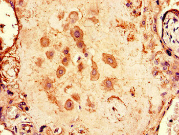 Immunohistochemistry of paraffin-embedded human placenta tissue using CSB-PA348885LA01HU at dilution of 1:100