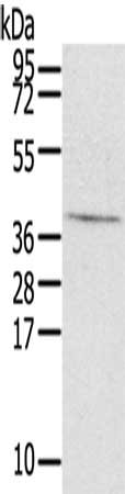Gel: 8%SDS-PAGE, Lysate: 40 ug, Lane: Mouse brain tissue, Primary antibody: CSB-PA349682(EFNB3 Antibody) at dilution 1/300, Secondary antibody: Goat anti rabbit IgG at 1/8000 dilution, Exposure time: 30 seconds