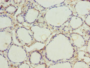 Immunohistochemistry of paraffin-embedded human thyroid tissue using CSB-PA349766LA01HU at dilution of 1:100