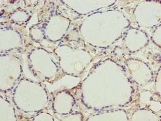 Immunohistochemistry of paraffin-embedded human thyroid tissue using CSB-PA349766LA01HU at dilution of 1:100