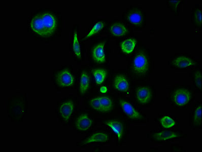 Immunofluorescence staining of A549 cells with CSB-PA349825HA01HU at 1:133, counter-stained with DAPI. The cells were fixed in 4% formaldehyde, permeabilized using 0.2% Triton X-100 and blocked in 10% normal Goat Serum. The cells were then incubat...