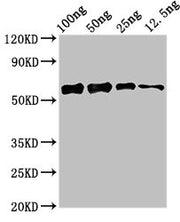 Western Blot Positive WB detected in Recombinant protein All lanes: ald1 antibody at 2.4ug/ml Secondary Goat polyclonal to rabbit IgG at 1/50000 dilution predicted band size: 57 kDa observed band size: 57 kDa