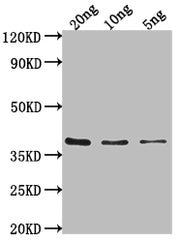 Western Blot Positive WB detected in Recombinant protein All lanes: hupB antibody at 1:2000 Secondary Goat polyclonal to rabbit IgG at 1/50000 dilution Predicted band size: 36 kDa Observed band size: 36 kDa