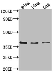 Western Blot Positive WB detected in Recombinant protein All lanes: hupB antibody at 1:2000 Secondary Goat polyclonal to rabbit IgG at 1/50000 dilution Predicted band size: 36 kDa Observed band size: 36 kDa