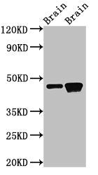 Western Blot Positive WB detected in: Rat brain tissue, Mouse brain tissue All lanes: GNAS antibody at 3µg/ml Secondary Goat polyclonal to rabbit IgG at 1/50000 dilution Predicted band size: 46, 45, 112, 110, 78, 29 kDa Observed band size: 46 kDa