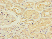 Immunohistochemistry of paraffin-embedded human kidney tissue using CSB-PA352689ESR1HU at dilution of 1:100