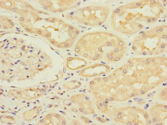 Immunohistochemistry of paraffin-embedded human kidney tissue using CSB-PA352689ESR1HU at dilution of 1:100