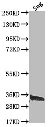 Western Blot Positive WB detected in Recombinant protein All lanes: US12 antibody at 1:2000 Secondary Goat polyclonal to rabbit IgG at 1/50000 dilution Predicted band size: 28 kDa Observed band size: 34 kDa