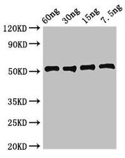 Western Blot Positive WB detected in Recombinant protein All lanes: ldh1 antibody at 2.7µg/ml Secondary Goat polyclonal to rabbit IgG at 1/50000 dilution Predicted band size: 51 kDa Observed band size: 51 kDa