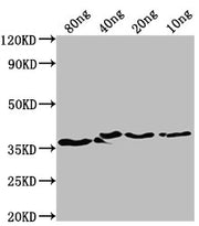 Western Blot Positive WB detected in Recombinant protein All lanes: bepA antibody at 1:2000 Secondary Goat polyclonal to rabbit IgG at 1/50000 dilution Predicted band size: 35 kDa Observed band size: 37 kDa