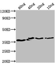 Western Blot Positive WB detected in Recombinant protein All lanes: bepA antibody at 1:2000 Secondary Goat polyclonal to rabbit IgG at 1/50000 dilution Predicted band size: 35 kDa Observed band size: 37 kDa