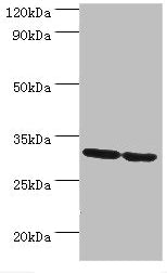 Western blot All lanes: PNP antibody at 10µg/ml Lane 1: Jurkat whole cell lysate Lane 2: K562 whole cell lysate Secondary Goat polyclonal to rabbit IgG at 1/10000 dilution Predicted band size: 32 kDa Observed band size: 32 kDa