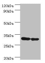 Western blot All lanes: PNP antibody at 6ug/ml Lane 1: Jurkat whole cell lysate Lane 2: k562 whole cell lysate Secondary Goat polyclonal to rabbit IgG at 1/10000 dilution Predicted band size: 32 kDa Observed band size: 32 kDa