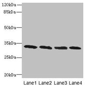 Western blot All lanes: PNP antibody at 16µg/ml Lane 1: Jurkat whole cell lysate Lane 2: K562 whole cell lysate Lane 3: U937 whole cell lysate Lane 4: 293T whole cell lysate Secondary Goat polyclonal to rabbit IgG at 1/10000 dilution Predicted ban...
