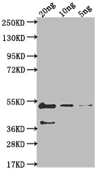 Western Blot Positive WB detected in Recombinant protein All lanes: gB antibody at 1:2000 Secondary Goat polyclonal to rabbit IgG at 1/50000 dilution Predicted band size: 43.3 kDa Observed band size: 46 kDa