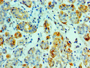 Immunohistochemistry of paraffin-embedded human salivary gland tissue using CSB-PA356351ESR2HU at dilution of 1:100