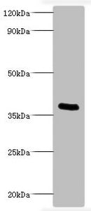 Western blot All lanes: Bordella pertussis pertussis toxin subunit 1 antibody at 2ug/ml + recombinant Bordella pertussis pertussis toxin subunit 1 100ng Secondary Goat polyclonal to rabbit IgG at 1/1000 dilution Predicted band size: 36 kDa Observe...