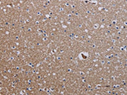 The image on the left is immunohistochemistry of paraffin-embedded Human brain tissue using CSB-PA356806(ZC3H12A Antibody) at dilution 1/25, on the right is treated with fusion protein. (Original magnification: ×200)