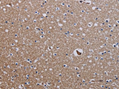 The image on the left is immunohistochemistry of paraffin-embedded Human brain tissue using CSB-PA356806(ZC3H12A Antibody) at dilution 1/25, on the right is treated with fusion protein. (Original magnification: ×200)