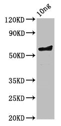 Western Blot Positive WB detected in Recombinant protein All lanes: ompA antibody at 3.6ug/ml Secondary Goat polyclonal to rabbit IgG at 1/50000 dilution Predicted band size: 58 kDa Observed band size: 58 kDa