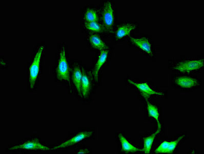 Immunofluorescent analysis of Hela cells using CSB-PA357550LA01HU at dilution of 1:100 and Alexa Fluor 488-congugated AffiniPure Goat Anti-Rabbit IgG(H+L)