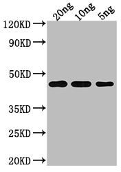 Western Blot Positive WB detected in Recombinant protein All lanes: TOXR antibody at 1:2000 Secondary Goat polyclonal to rabbit IgG at 1/50000 dilution Predicted band size: 44.21 kDa Observed band size: 44 kDa