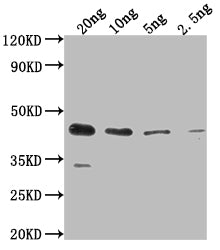 Western Blot Positive WB detected in Recombinant protein All lanes: ihfB antibody at 1:2000 Secondary Goat polyclonal to rabbit IgG at 1/50000 dilution Predicted band size: 38.5 kDa Observed band size: 44 kDa